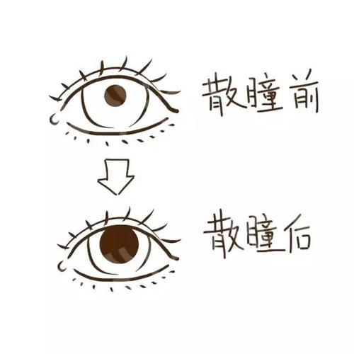 散瞳有什么副作用没有副作用,散瞳有什么副作用没有副作用的
