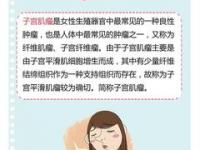 子宫肌瘤的症状(子宫肌瘤的症状有哪些表现自测)