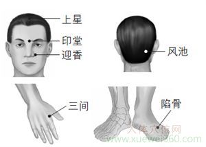 鼻塞穴位