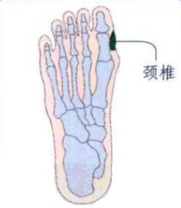 脚底穴位图（脚底反射区）–颈椎